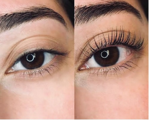Eye Treatments Eye Treatments